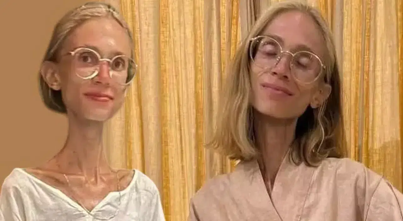 Polonyalı Influencer Bali'de Tatilde Hayatını Kaybetti