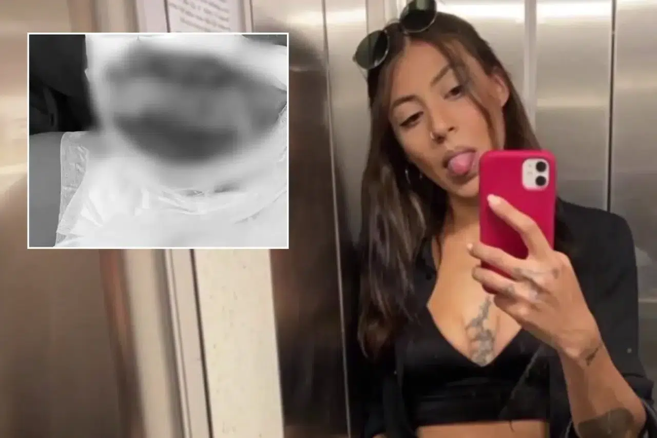 Kadıköy'de Kıskançlık Krizi: Genç Kadın Yanıcı Maddeyle Ateşe Verildi