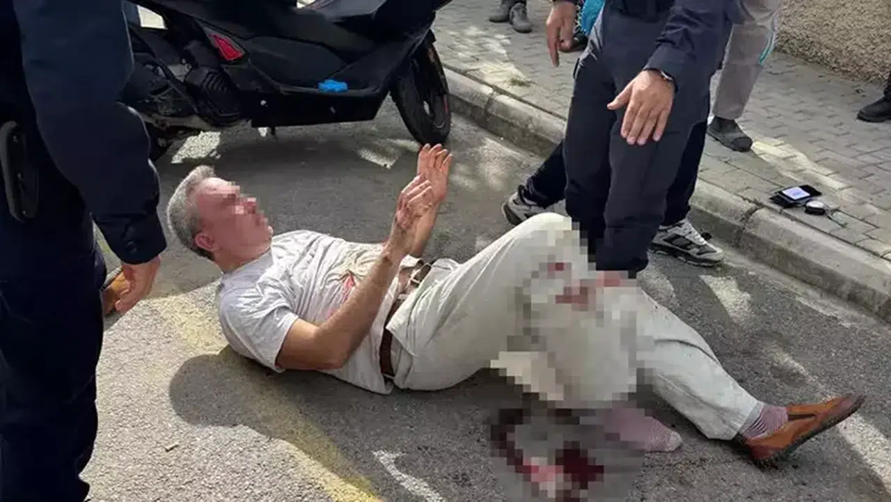 Boşanma Sürecinde İletişimsizlik, Bıçaklı Kavgaya Dönüştü