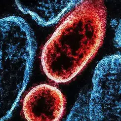 "Nipah Virüsünün Türkiye Üzerindeki Tehdit Seviyesi Düşük"