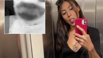 Kadıköy'de Kıskançlık Krizi: Genç Kadın Yanıcı Maddeyle Ateşe Verildi