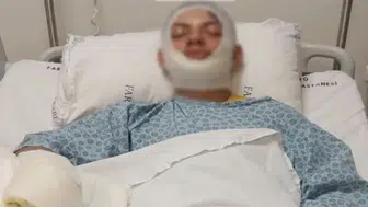 Araklı'da Benzinle Ateş Yakarken Yaralanan Yiğit Demir Taburcu Oldu