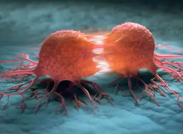 DSÖ: Kanser Vakalarının %37'si Önlenebilir Nedenlerden Kaynaklanıyor