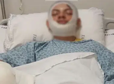 Araklı'da Benzinle Ateş Yakarken Yaralanan Yiğit Demir Taburcu Oldu