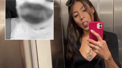 Kadıköy'de Kıskançlık Krizi: Genç Kadın Yanıcı Maddeyle Ateşe Verildi