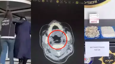 Kayseri'de 500 Gram Metamfetamin Midesinde Taşıyan Süpheli Yakalandı