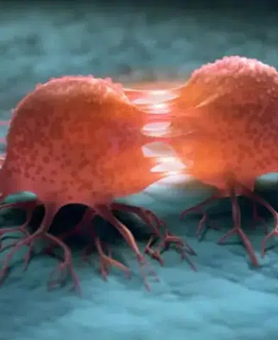 DSÖ: Kanser Vakalarının %37'si Önlenebilir Nedenlerden Kaynaklanıyor