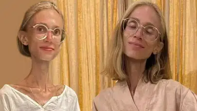 Polonyalı Influencer Bali'de Tatilde Hayatını Kaybetti