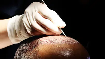 Trabzon'da Saç Ekimi Sırasında Fenalaşan Hasta Hayatını Kaybetti