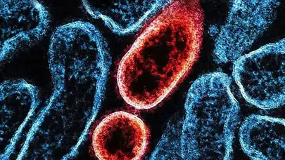 "Nipah Virüsünün Türkiye Üzerindeki Tehdit Seviyesi Düşük"