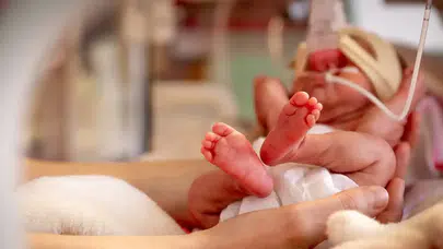 Prematüre Bebeklerin Multidisipliner İzlenmesi Hayati Öneme Sahip