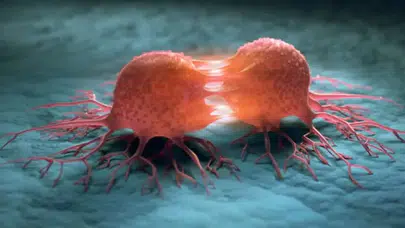 DSÖ: Kanser Vakalarının %37'si Önlenebilir Nedenlerden Kaynaklanıyor