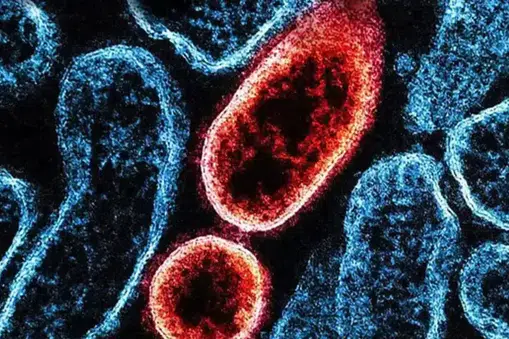 "Nipah Virüsünün Türkiye Üzerindeki Tehdit Seviyesi Düşük"