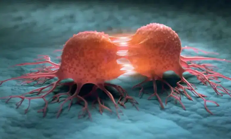 DSÖ: Kanser Vakalarının %37'si Önlenebilir Nedenlerden Kaynaklanıyor