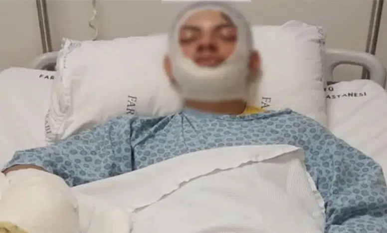 Araklı'da Benzinle Ateş Yakarken Yaralanan Yiğit Demir Taburcu Oldu