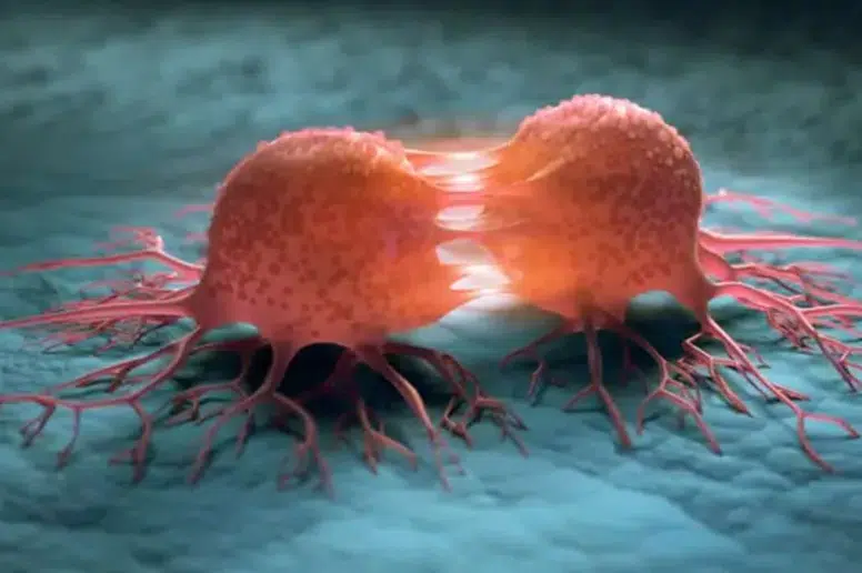 DSÖ: Kanser Vakalarının %37'si Önlenebilir Nedenlerden Kaynaklanıyor